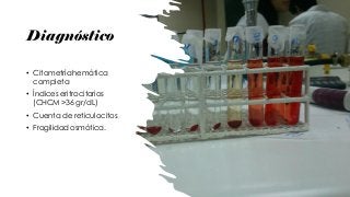 Diagnóstico
• Citometría hemática
completa
• Índices eritrocitarios
(CHCM >36 gr/dL)
• Cuenta de reticulocitos
• Fragilidad osmótica.
 
