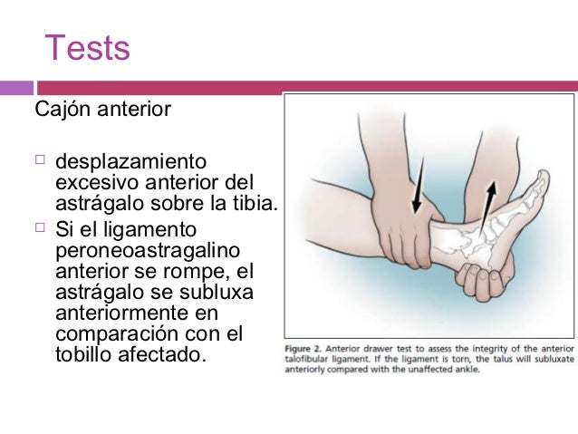 Estando sobre la espalda duele bajo el borde izquierdo