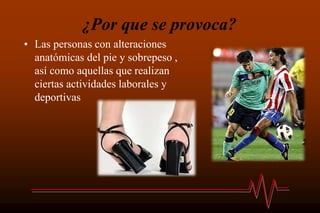¿Por que se provoca?
• Las personas con alteraciones
anatómicas del pie y sobrepeso ,
así como aquellas que realizan
ciertas actividades laborales y
deportivas
 