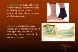 • Compresión: es bueno aplicar un
vendaje elástico compresivo sobre
el tobillo y pierna, para dar
estabilidad al pie además de evitar
el edema excesivo.
• Elevación: mantener la pierna
elevada en los momentos en que se
esté reposando ayudará a su
descanso y evitará el aumento del
edema en la zona.
 