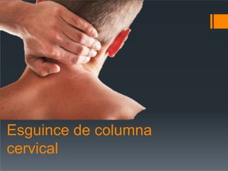 Esguince de columna
cervical
 
