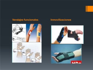 Vendajes funcionales Inmovilizaciones
 