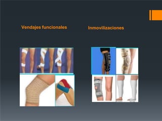 Vendajes funcionales Inmovilizaciones
 