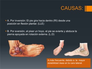 CAUSAS:
 A. Por inversión: El pie gira hacia dentro (RI) desde una
posición en flexión plantar. (LLE)
 B. Por eversión, al pisar un hoyo, el pie se evierte y abduce la
pierna apoyada en rotación externa. (L.D)
A.más frecuente, debido a la mayor
estabilidad ósea en la cara lateral.
 
