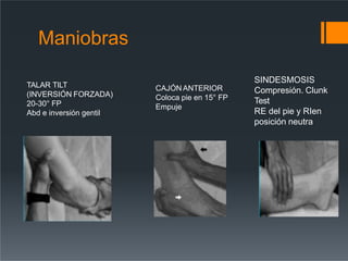Maniobras
TALAR TILT
(INVERSIÓN FORZADA)
20-30° FP
Abd e inversión gentil
CAJÓN ANTERIOR
Coloca pie en 15° FP
Empuje
SINDESMOSIS
Compresión. Clunk
Test
RE del pie y RIen
posición neutra
 