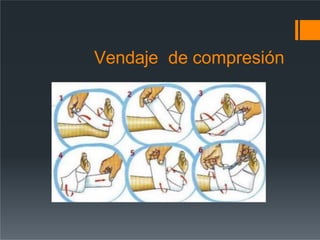 Vendaje de compresión
 