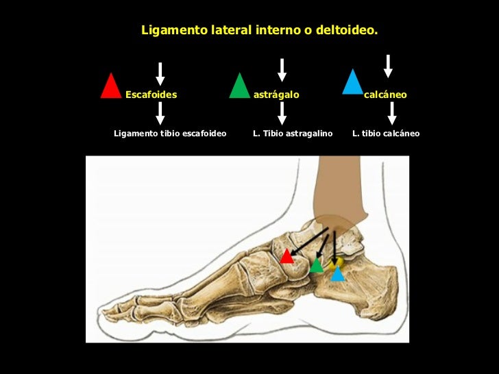 Esguince Ligamento Lateral Externo Tobillo Esguinces de tobillo