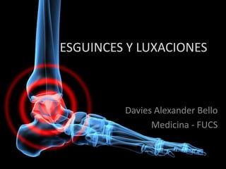 ESGUINCES Y LUXACIONES



         Davies Alexander Bello
               Medicina - FUCS
 