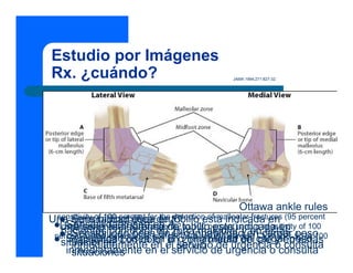 Estudio por Imágenes
Rx. ¿cuándo?                                  JAMA 1994;271:827-32.




                                                  Ottawa ankle rules
Una serieof 100 percent fordeAC
  sensitivity radiográfica en tobillo esta indicada en (95 percent
      Sensibilidad ósea the detection of malleolar fractures
   confidence intervalósea en 82 to 100 esta and a sensitivity
    Sensibilidad [CI]; range:
   Una serie radiográfica de tobillopercent)indicada en of 100
   pacientes con dolor en zona maleolar y en estas peso
 percent for the detection of midfootoo inhabilidad en cargar 95 to 100
      Sensibilidad ósea en D inhabilidad en CI; range:
    Sensibilidad ósea en en fractures (95 percent cargar peso
                                  B zona
   situaciones con dolor el percent) media del pié y en estas
      pacientes
    inmediatamente en el servicio de urgencia oo consulta
      inmediatamente en servicio de urgencia consulta
      situaciones
 