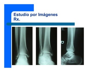 Estudio por Imágenes
Rx.
 