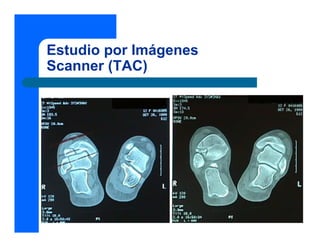 Estudio por Imágenes
Scanner (TAC)
 