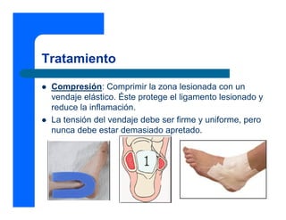 Tratamiento

 Compresión: Comprimir la zona lesionada con un
 vendaje elástico. Éste protege el ligamento lesionado y
 reduce la inflamación.
 La tensión del vendaje debe ser firme y uniforme, pero
 nunca debe estar demasiado apretado.
 