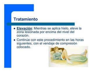 Tratamiento

 Elevación: Mientras se aplica hielo, eleve la
 zona lesionada por encima del nivel del
 corazón.
 Continúe con este procedimiento en las horas
 siguientes, con el vendaje de compresión
 colocado.
 