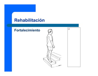 Rehabilitación

Fortalecimiento
 