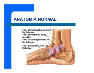 ANATOMIA NORMAL
 