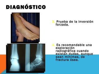 DIAGNÓSTICO 
3. Prueba de la inversión 
forzada. 
4. Es recomendable una 
exploración 
radiográfica cuando 
existan dudas, aunque 
sean mínimas, de 
fractura ósea. 
 