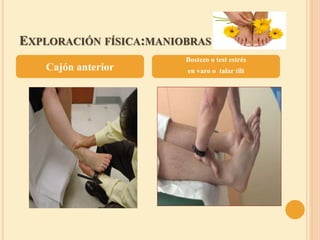 EXPLORACIÓN FÍSICA:MANIOBRAS
Cajón anterior
Bostezo o test estrés
en varo o talar tilt
 