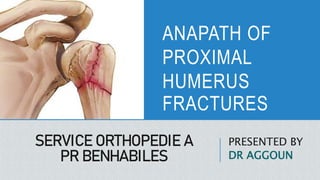 SERVICE ORTHOPEDIE A
PR BENHABILES
PRESENTED BY
DR AGGOUN
ANAPATH OF
PROXIMAL
HUMERUS
FRACTURES
 