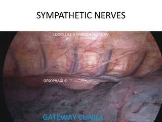 SYMPATHETIC NERVES
OESOPHAGUS
LOOKS LIKE A NARROW WINDOW
 
