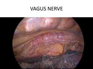 VAGUS NERVE
 