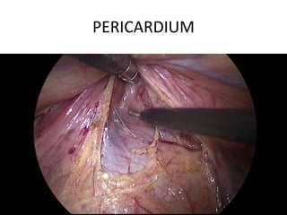 PERICARDIUM
 