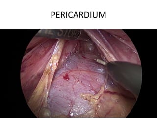 PERICARDIUM
 