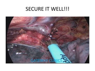 SECURE IT WELL!!!
 
