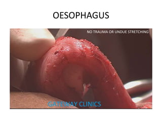 OESOPHAGUS
NO TRAUMA OR UNDUE STRETCHING
 