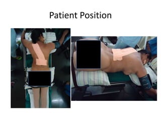 Patient Position
 
