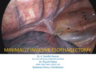Thoroacolaparoscopic
Esophagectomy
Dr. K. Sendhil Kumar
MS, FICS, FACS(USA), DNB(SURG GASTRO)
Dr. Piyush Patwa
MBBS. DNB, FMAS, FIAGES, FAIS
Gateway Clinics, Coimbatore
MINIMALLY INVASIVE ESOPHAGECTOMY
 