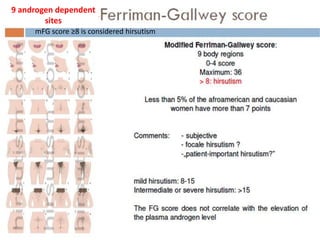 Recent 2018 ESHRE & ASRM evidence based guidelines for PCOS assement | PDF