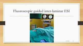 Epidural Steroid Injection in low back pain | PPTX
