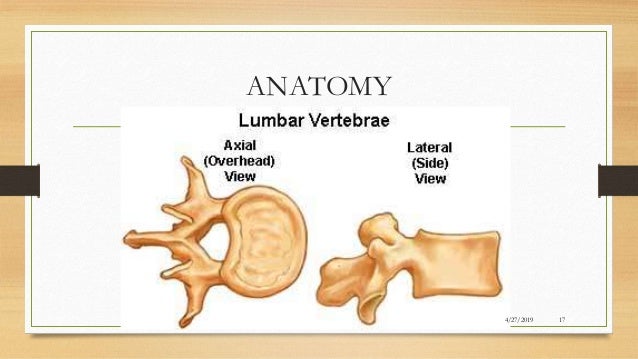 Epidural Steroid Injection in low back pain