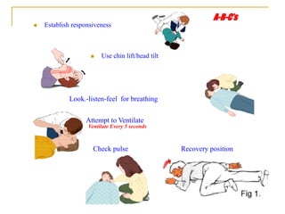 A-B-C’s
 Use chin lift/head tilt
Look.-listen-feel for breathing
Attempt to Ventilate
Ventilate Every 5 seconds
 Establish responsiveness
Check pulse Recovery position
 