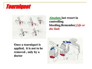 Tourniquet
Absolute last resort in
controlling
bleeding,Remember Life or
the limb
Once a tourniquet is
applied, it is not to be
removed , only by a
doctor
 
