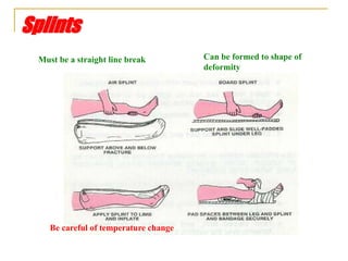 Splints
Must be a straight line break Can be formed to shape of
deformity
Be careful of temperature change
 