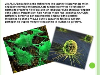 2)MALINJE:nga latinishtja Malingnens-me veprim te keq;Kur ato rriten
shpejt dhe formoje Metastaza.Keto tumore nderhyjne ne...