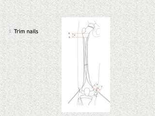  Trim nails
 