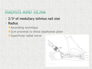  2/3rd
of medullary isthmus nail size
 Radius
 Ascending technique
 2cm proximal to distal epiphyseal plate
 Superficial radial nerve
 