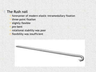  The Rush nail
 forerunner of modern elastic intramedullary fixation
 three-point fixation
 slightly flexible
 pre-bent
 rotational stability was poor
 flexibility was insufficient
 