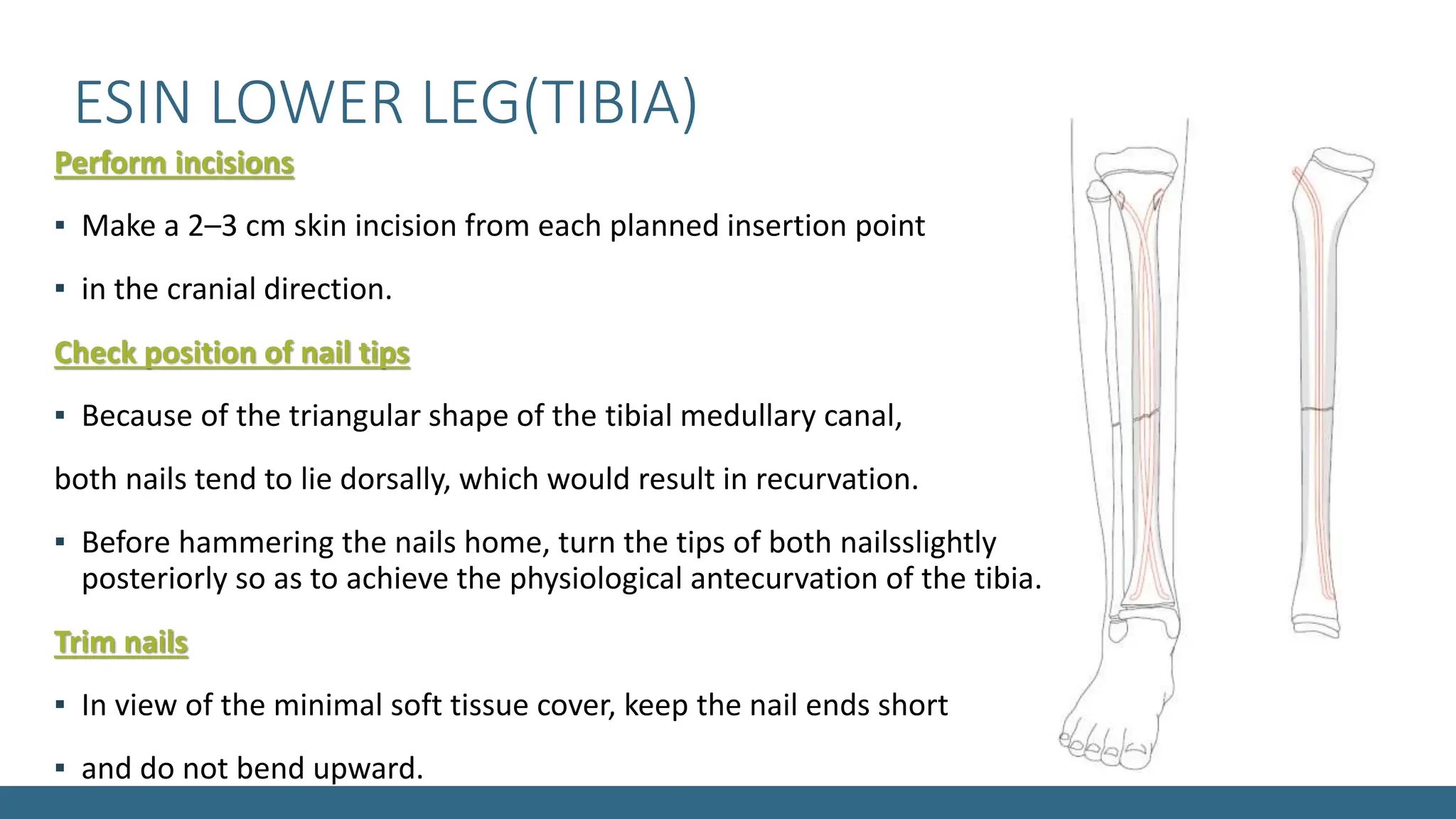 ESIN LOWER LIMB FEMUR AND TIBIA FRACTURES .pptx