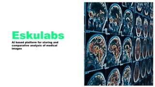 EskulabsAI based platform for storing and
comparative analysis of medical
images
 