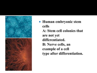  Human embryonic stem
cells
A: Stem cell colonies that
are not yet
differentiated.
B: Nerve cells, an
example of a cell
type after differentiation.
 