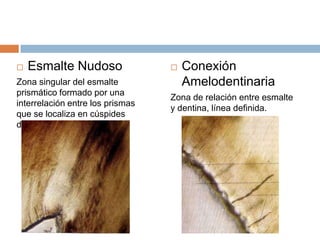  Esmalte Nudoso
Zona singular del esmalte
prismático formado por una
interrelación entre los prismas
que se localiza en cúspides
dentarias.
 Conexión
Amelodentinaria
Zona de relación entre esmalte
y dentina, línea definida.
 