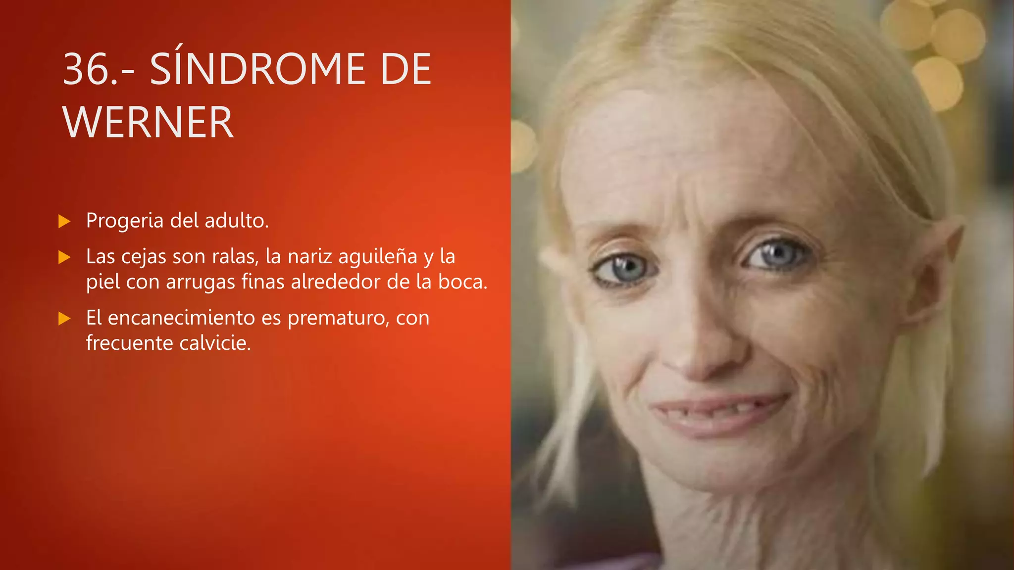 TIPOS DE FACIES | PPT