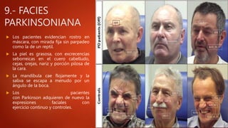 9.- FACIES
PARKINSONIANA
 Los pacientes evidencian rostro en
máscara, con mirada fija sin parpadeo
como la de un reptil.
 La piel es grasosa, con excrecencias
seborreicas en el cuero cabelludo,
cejas, orejas, nariz y porción pilosa de
la cara.
 La mandíbula cae flojamente y la
saliva se escapa a menudo por un
ángulo de la boca.
 Los pacientes
con Parkinson adquieren de nuevo la
expresiones faciales con
ejercicio continuo y controles.
 