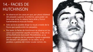 14.- FACIES DE
HUTCHINSON
 Se observa en los casos en que, por ptosis bilateral
del párpado superior, el enfermo, para poder ver,
tiene que echar la cabeza hacia atrás y fruncir
fuertemente el músculo frontal.
 Sólo así le es posible dirigir la visual a través de la
fisura que queda entre los párpados.
 Por tanto, la facies de Hutchinson se observa en los
casos que presentan aquella anomalía, o sea, en la
OFTALMOPLEJÍA NUCLEAR PROGRESIVA, en la
ptosis congénita de los párpados ligada a agenesia
del elevador del párpado, en las tabes, en la
parálisis o paresia del motor ocular común, etc.
 