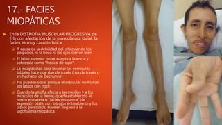 17.- FACIES
MIOPÁTICAS
 En la DISTROFIA MUSCULAR PROGRESIVA de
Erb con afectación de la musculatura facial, la
facies es muy característica.
 A causa de la debilidad del orbicular de los
párpados, ni la boca ni los ojos cierran bien.
 El labio superior no se adapta a la encía y
sobresale como "hocico de tapir".
 La incapacidad para levantar las comisuras
labiales hace que rían de través (risa de través o
en hachazo, de Dechunne)
 No pueden silbar porque el orbicular no frunce
los labios con rigor.
 Cuando la atrofia afecta a las mejillas y a los
músculos de la frente, queda establecido el
rostro en careta o "facíes miopática" de
expresión triste, con los ojos entreabierto y los
labios perezosos. Pueden llegarse a la
lagoftalmía miopática.
 