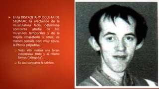  En la DISTROFIA MUSCULAR DE
STEINERT, la afectación de la
musculatura facial determina
constante atrofia de los
músculos temporales y de la
mejilla (maseteros y otros) es
menos común, pero muy típica,
la Ptosis palpebral.
 Todo ello motiva una facies
inexpresiva, triste y al mismo
tiempo "alargada".
 Es casi constante la calvicie.
 