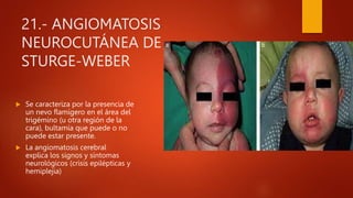 21.- ANGIOMATOSIS
NEUROCUTÁNEA DE
STURGE-WEBER
 Se caracteriza por la presencia de
un nevo flamígero en el área del
trigémino (u otra región de la
cara), bultamía que puede o no
puede estar presente.
 La angiomatosis cerebral
explica los signos y síntomas
neurológicos (crisis epilépticas y
hemiplejia)
 
